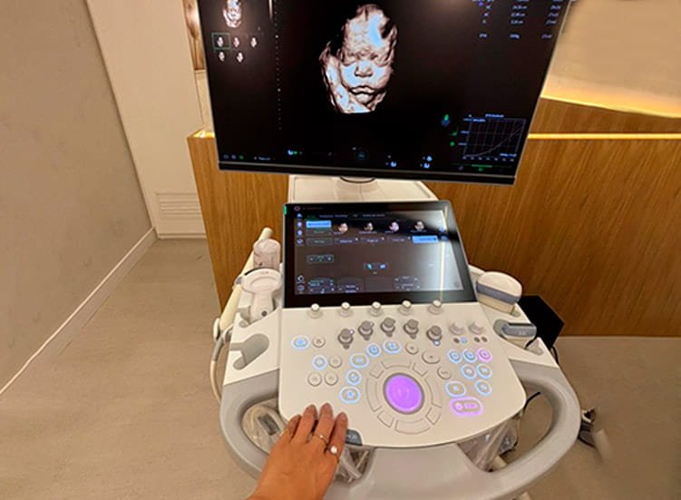 Ultrassom 3D e 4 D