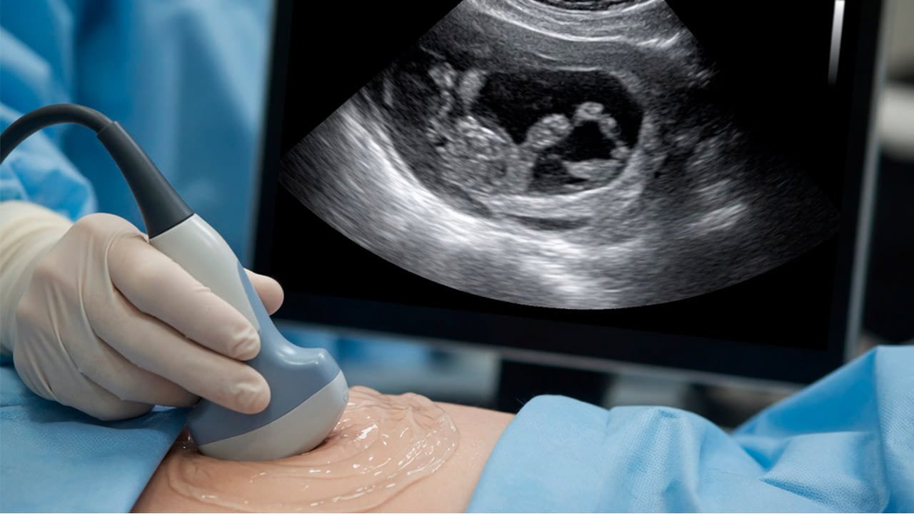 Médico realizando exame para ver se a endometriose intestinal aparece no ultrassom