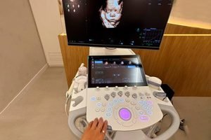 Ultrassom 3D e 4 D
